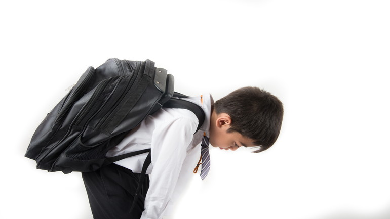 リュックを背負うこともできなくなった側弯症による背中の痛み